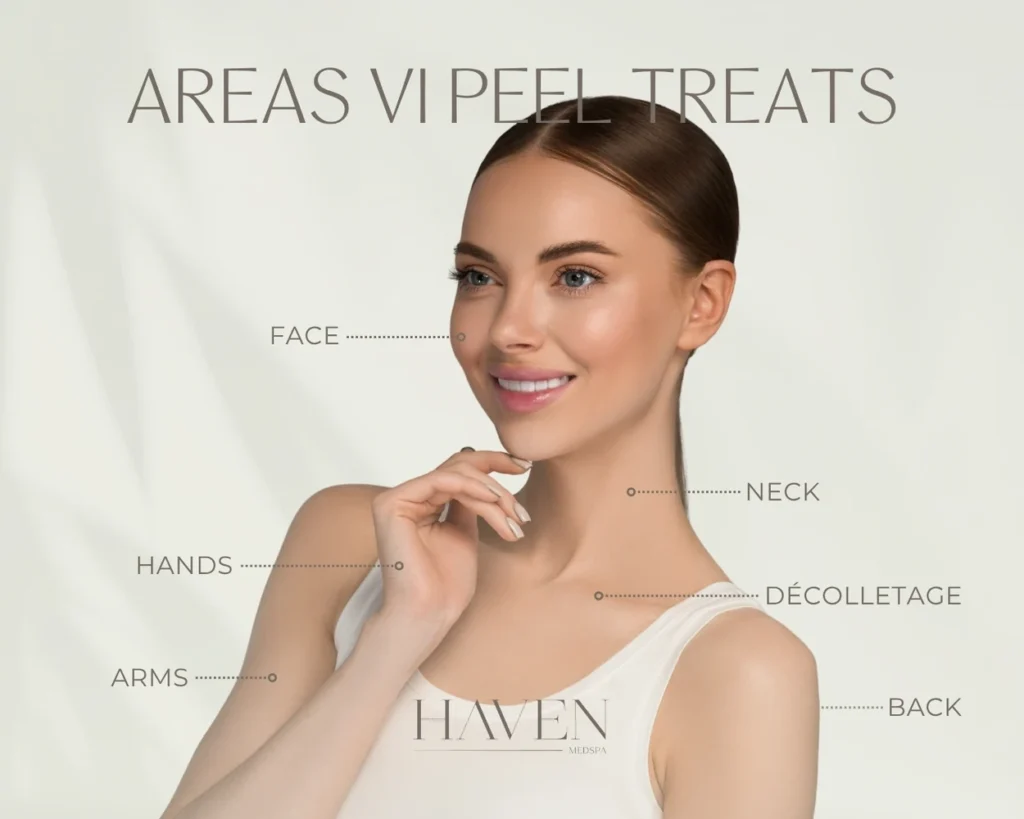 Illustration showing facial and body areas the VI Peel treats, including the face, neck, décolletage, back, arms, and hands, highlighting skin tone, texture, and clarity improvements.